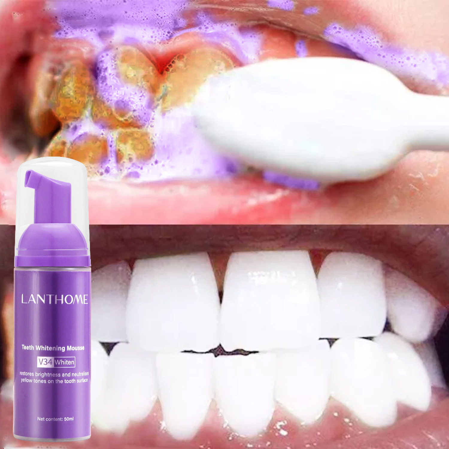 Teeth Whitening Bleach - V34 ホワイトニングムース歯磨き粉 歯垢除去 ステイン除去 口腔衛生 ブリーチング