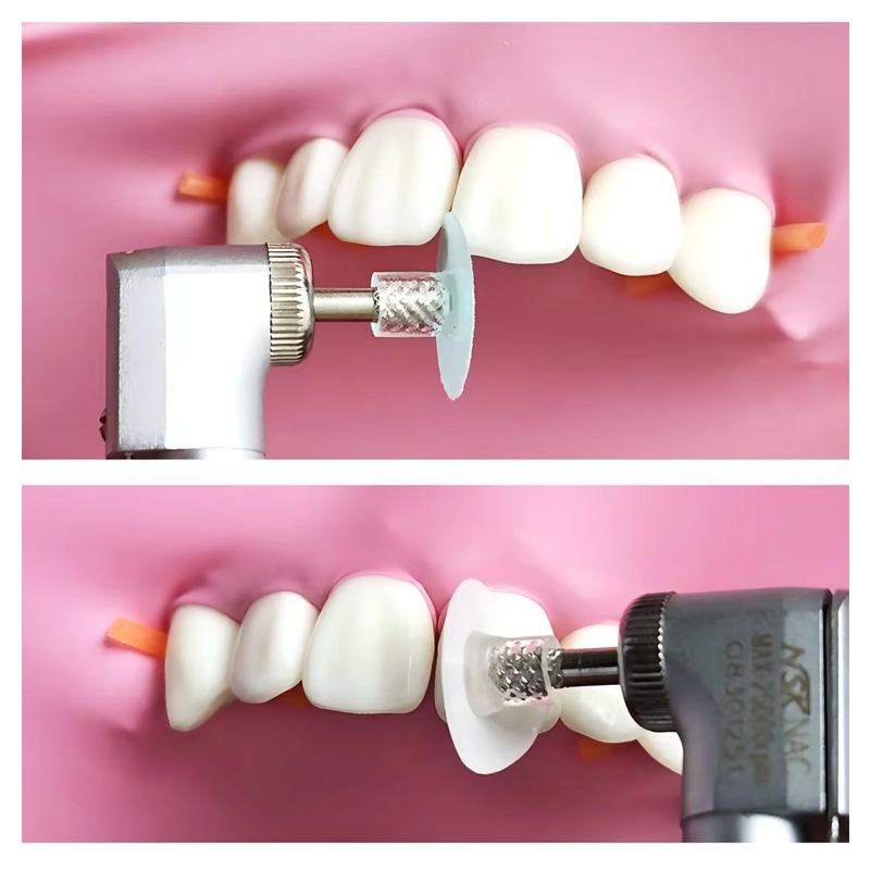 40個入り歯科研磨ディスク、コンポジットレジン仕上げ研磨ステ - Whitening Teeth Dentist のレビューと価格
