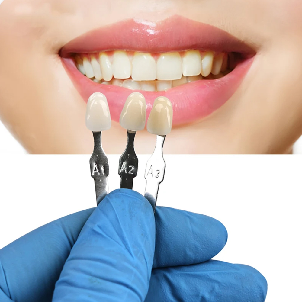 VITA 16 色歯の色見本ガイド歯科ホワイトニング研磨キッ - Teeth Whitening Shade Guide のレビューと価格