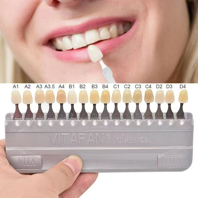 VITA 16色歯色ガイド クラシック歯科用歯のホワイトニン - Teeth Whitening Shade Guide のレビューと価格