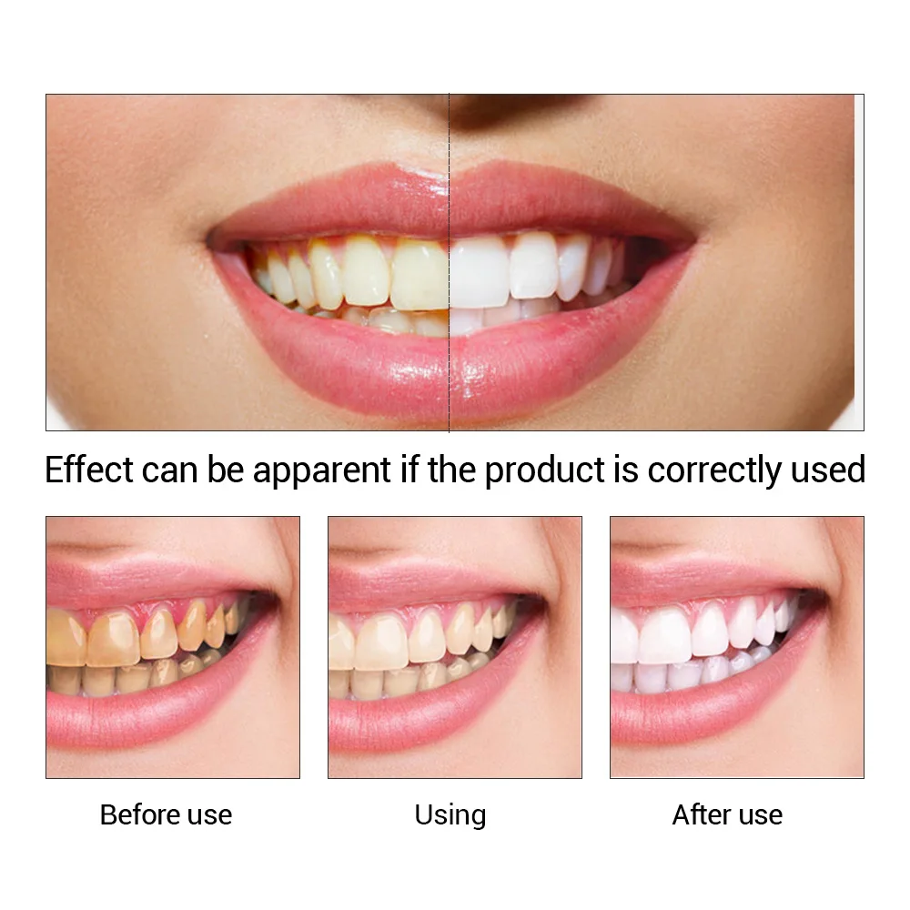 歯のホワイトニングエッセンス,口腔衛生,歯のホワイトニング, - Teeth Whitening Bleach のレビューと価格