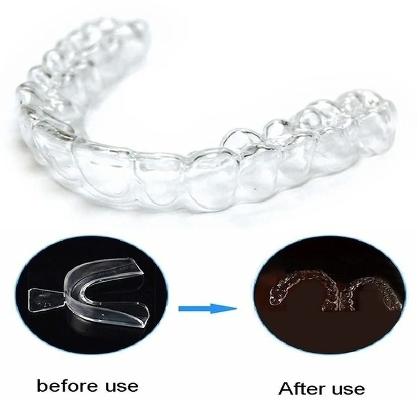 いびき防止歯ぎしり睡眠マウスガードナイトガードガムシールドマ - Dental Guard Night のレビューと価格