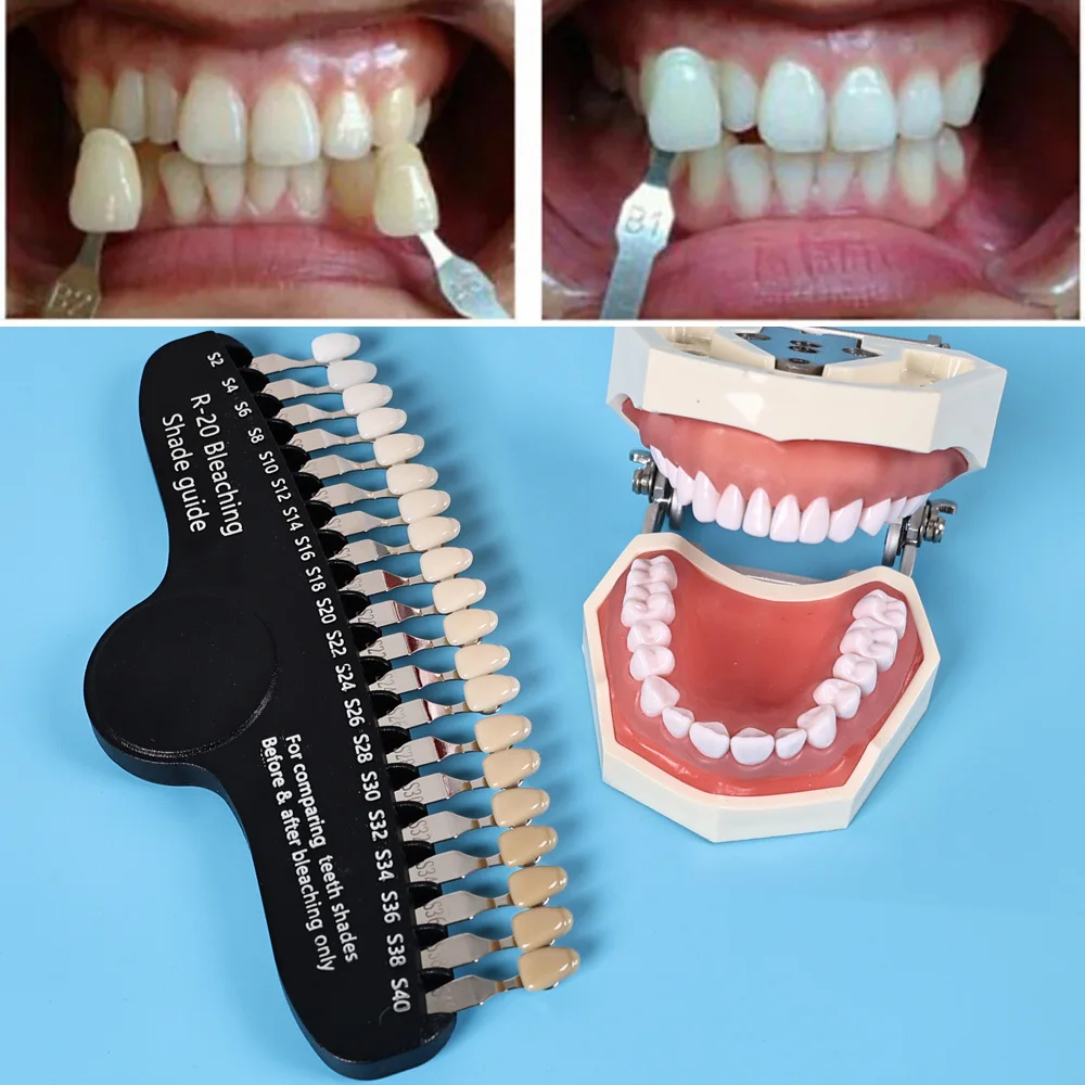 エリヤ R-20 漂白シェードガイド歯科 20 色 3D 歯 - Teeth Whitening Shade Guide のレビューと価格