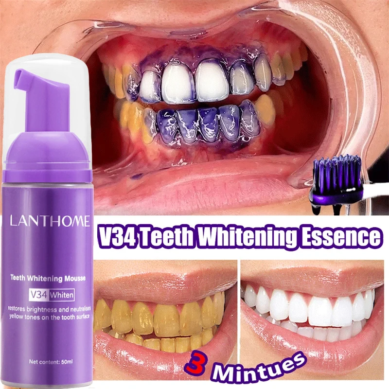 V34 ホワイトニングムース歯磨き粉 歯垢除去 ステイン除去 - Teeth Whitening Bleach のレビューと価格
