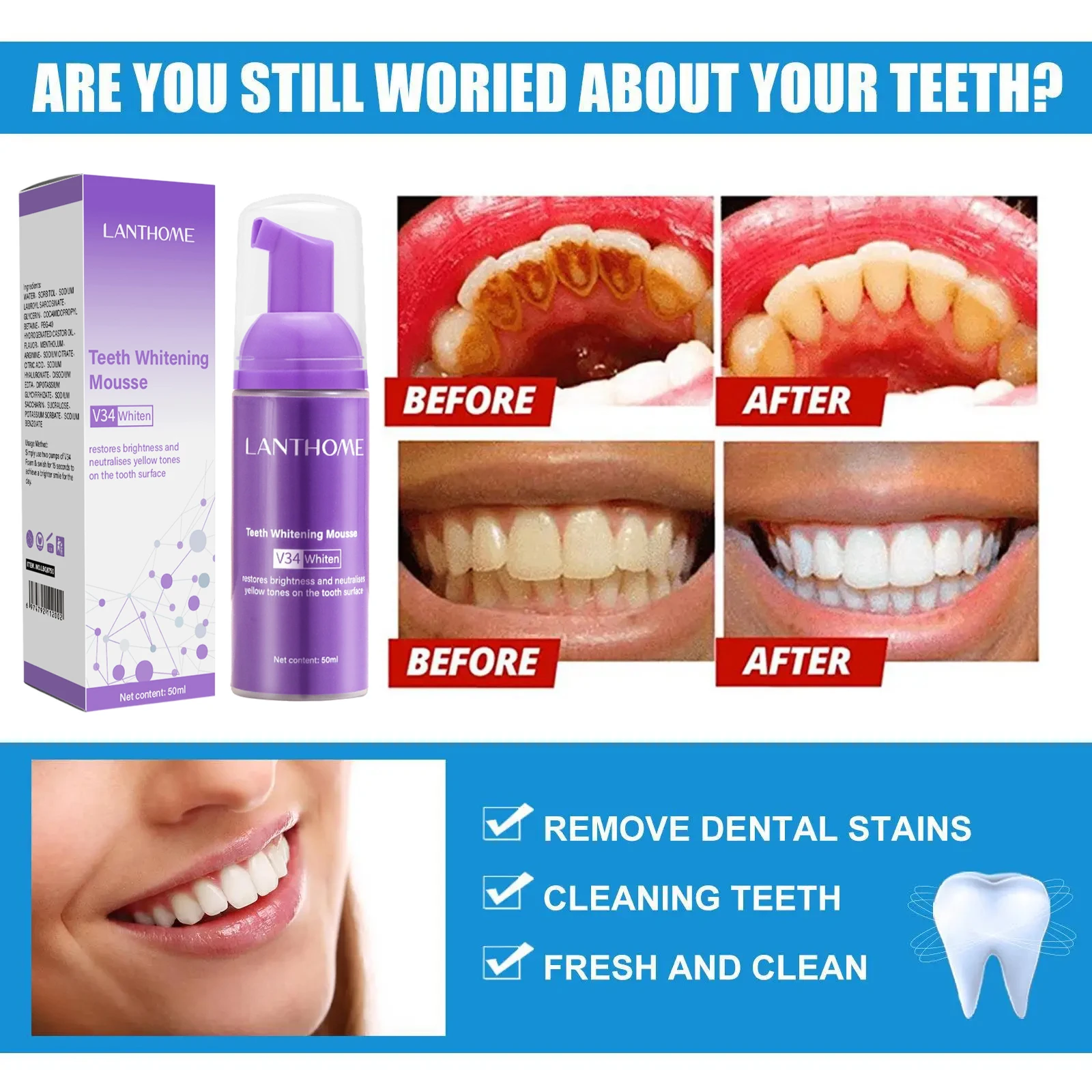 V34 ホワイトニングムース歯磨き粉 歯垢除去 ステイン除去 - Teeth Whitening Bleach のレビューと価格