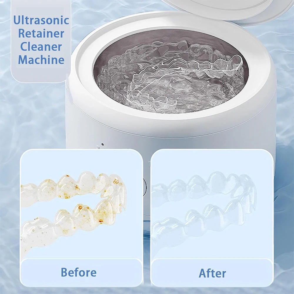 USB給電式歯科器具洗浄機（矯正器具、入れ歯、ジュエリー用） - Teeth Whitening Device のレビューと価格