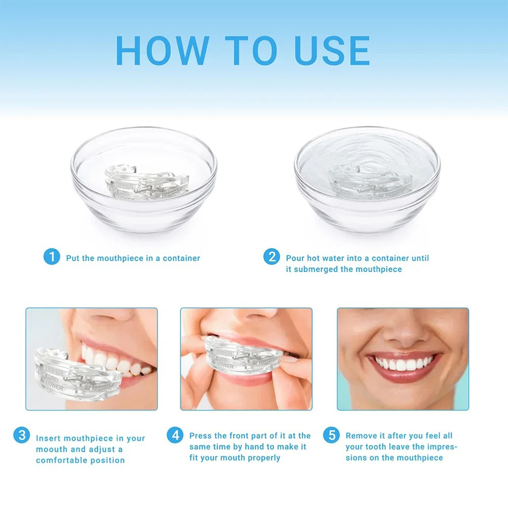 1/2/3/4/5 個、いびき防止歯ぎしりマウスガード睡眠を - Dental Guard Night のレビューと価格