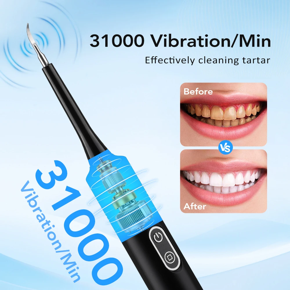 電気音波振動歯科用スケーラー歯のホワイトニング歯垢除去コーヒ - Whitening Teeth Dentist のレビューと価格